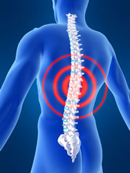 Back pain treatment Rockwall, TX